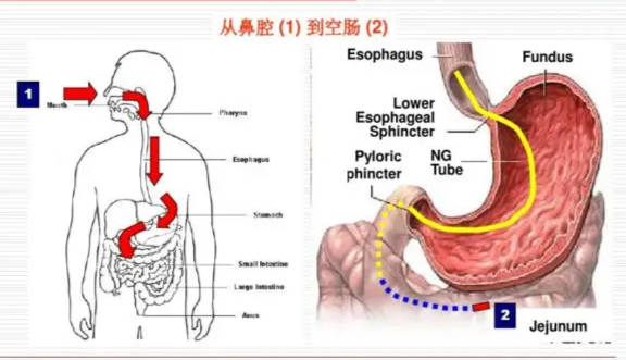 鼻空肠管构造图片